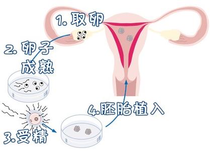 关于私人孕妈供卵代怀服务选性别